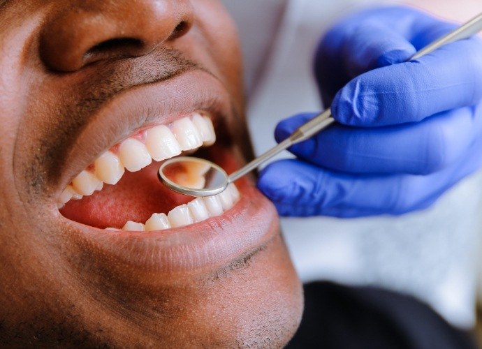 Dentist examining patient's smile after metal free dental restoration