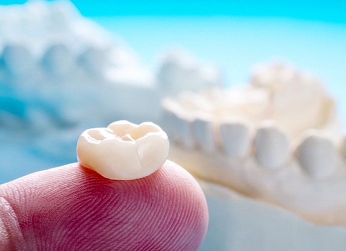 Dental crown in Palo Alto on fingertip