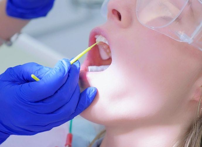 Patient receiving fluoride treatment