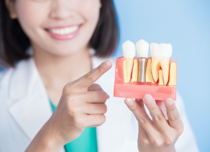 Dentist pointing to dental implant supported replacement tooth model